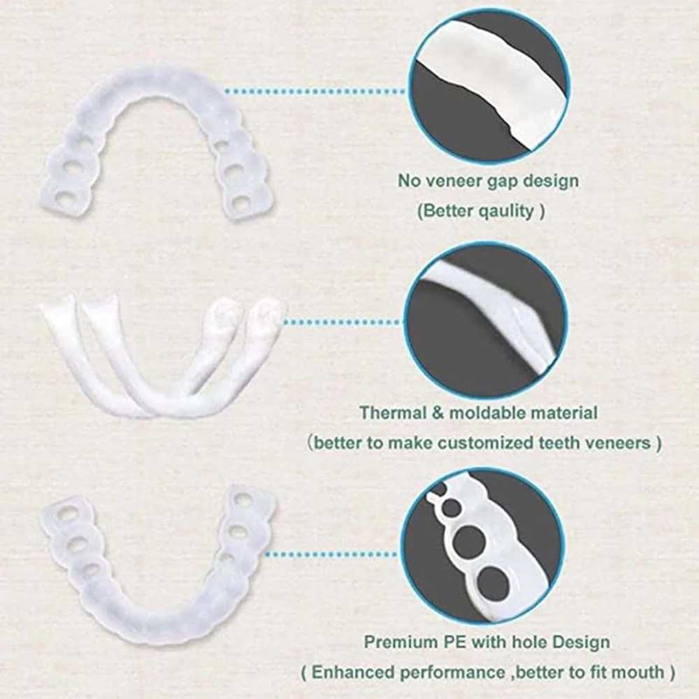 SnapOn Smile Dental Veneer